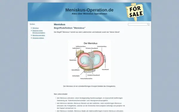 meniskus-operation.de