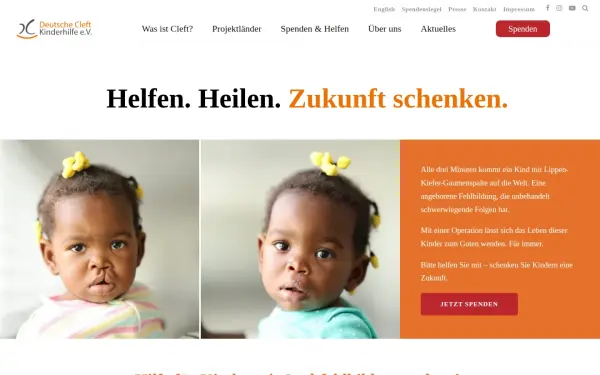 www.spaltkinder.org