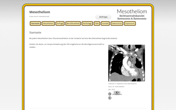 mesotheliom.de
