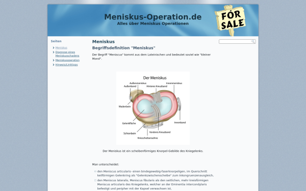 meniskus-operation.de