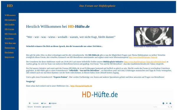 hd-huefte.de