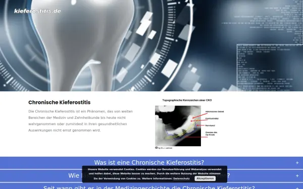 kieferostitis.de