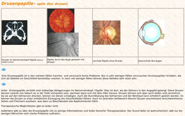 drusenpapille.de