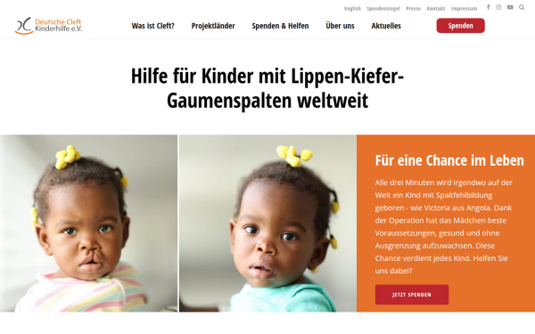 www.spaltkinder.org