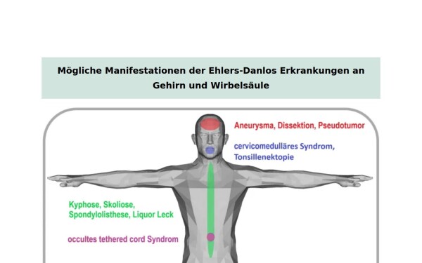 neuro-eds.ch